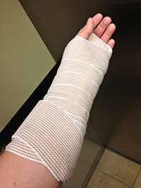 Jake Donahue Broken Hand